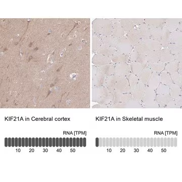 Anti-KIF21A antibody produced in rabbit, 100 µL (HPA058432-100UL)
