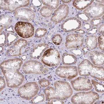 Anti-COA5 antibody produced in rabbit, 1 X 100 µL (HPA057768-100UL)