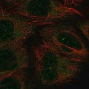 Anti-CHODL antibody produced in rabbit, 1 X 100 µL (HPA057559-100UL)