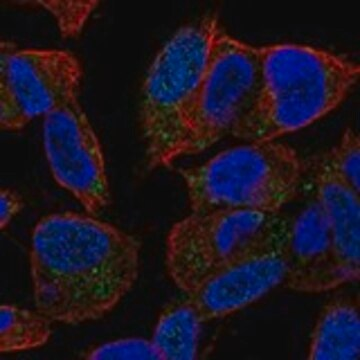 Anti-SPAG11B antibody produced in rabbit, 1 X 100 µL (HPA057479-100UL)