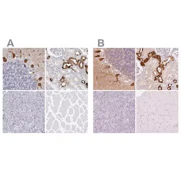 Anti-CALB1 antibody produced in rabbit, 100 µL (HPA056734-100UL)