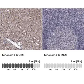 Anti-SLC39A14 antibody produced in rabbit, 1 X 100 µL (HPA056732-100UL)