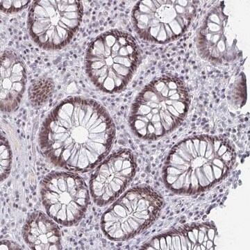 Anti-LIN54 antibody produced in rabbit, 1 X 100 µL (HPA056606-100UL)