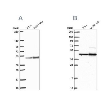 Anti-ARFGAP1 antibody produced in rabbit, 100 µL (HPA056273-100UL)