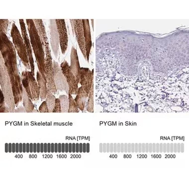 Anti-PYGM antibody produced in rabbit, 1 X 100 µL (HPA056003-100UL)