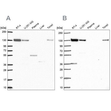 Anti-CAND1 antibody produced in rabbit, 100 µL (HPA055748-100UL)