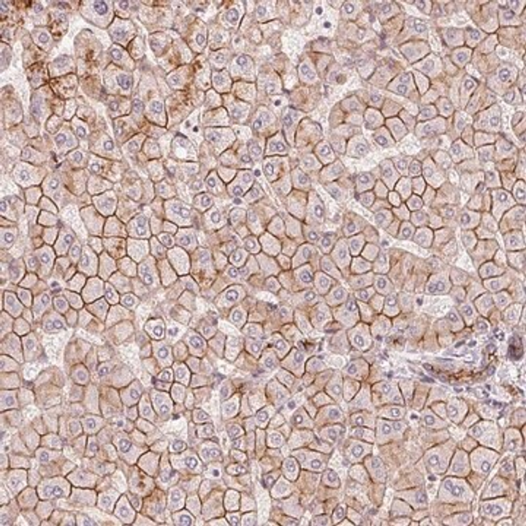 Anti-SLC17A4 antibody produced in rabbit, 100 µL (HPA055564-100UL)