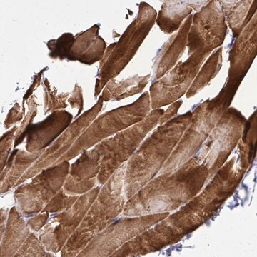 Anti-ST6GALNAC3 antibody produced in rabbit, 1 X 100 µL (HPA055399-100UL)