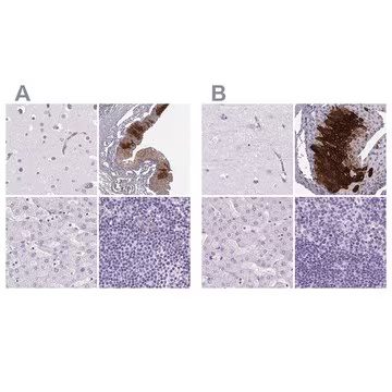 Anti-KRT12 antibody produced in rabbit, 100 µL (HPA055217-100UL)