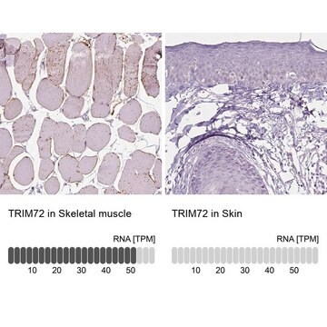 Anti-TRIM72 antibody produced in rabbit, 100 µL (HPA054909-100UL)