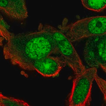 Anti-RGS12 antibody produced in rabbit, 100 µL (HPA054646-100UL)