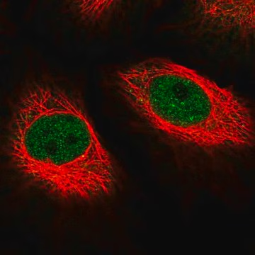 Anti-MED10 antibody produced in rabbit, 100 µL (HPA054188-100UL)