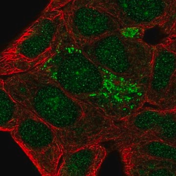 Anti-DHRS2 antibody produced in rabbit, 100 µL (HPA053915-100UL)