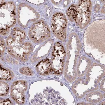 Anti-OSBPL7 antibody produced in rabbit, 100 µL (HPA053083-100UL)