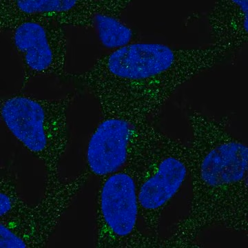 Anti-DKK2 antibody produced in rabbit, 100 µL (HPA052611-100UL)