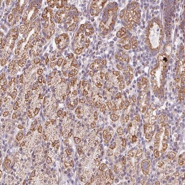 Anti-ZNF615 antibody produced in rabbit, 1 X 100 µL (HPA052422-100UL)