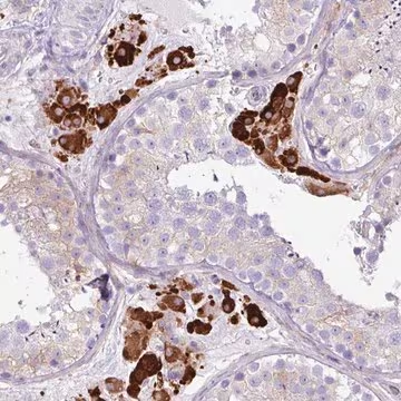 Anti-SLC38A1 antibody produced in rabbit, 1 X 100 µL (HPA052272-100UL)