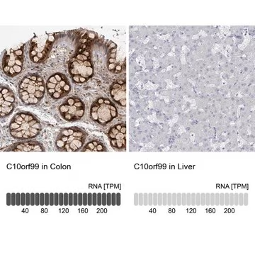 Anti-C10ORF99 antibody produced in rabbit, 1 X 100 µL (HPA050920-100UL)