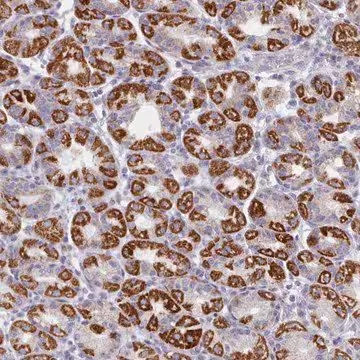 Anti-FAM170B antibody produced in rabbit, 1 X 100 µL (HPA050610-100UL)