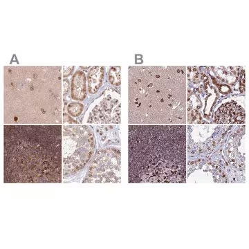 Anti-TOR1AIP1 antibody produced in rabbit, 1 X 100 µL (HPA050546-100UL)
