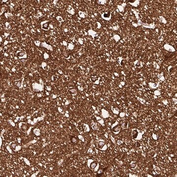 Anti-NAPA antibody produced in rabbit, 1 X 100 µL (HPA050196-100UL)