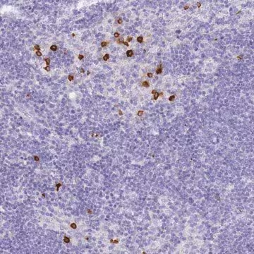 Anti-HERC1 antibody produced in rabbit, 1 X 100 µL (HPA049749-100UL)