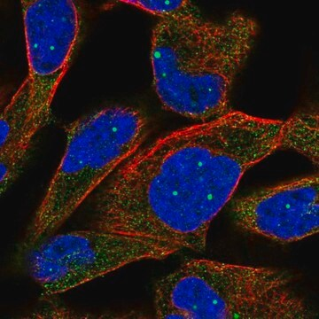 Anti-TPP2 antibody produced in rabbit, 100 µL (HPA049630-100UL)