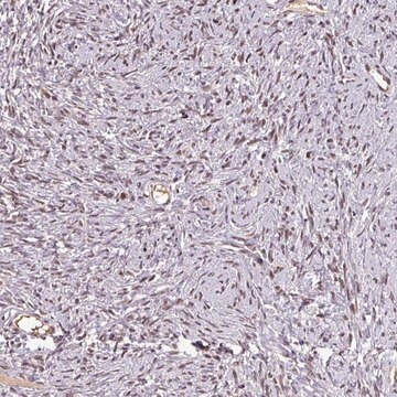 Anti-NOB1 antibody produced in rabbit, 1 X 100 µL (HPA049430-100UL)