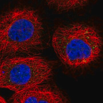 Anti-RDH10 antibody produced in rabbit, 100 µL (HPA049199-100UL)
