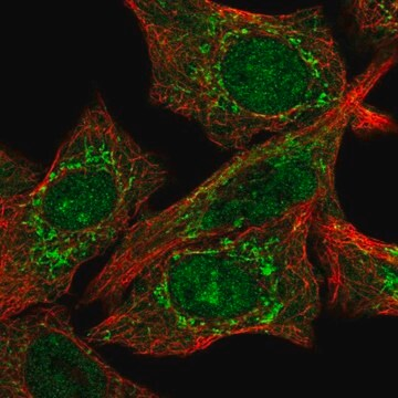Anti-CLPX antibody produced in rabbit, 100 µL (HPA048199-100UL)