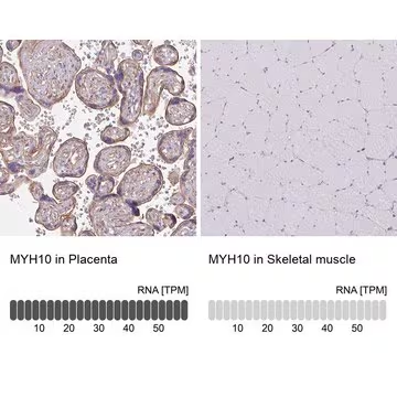 Anti-MYH10 antibody produced in rabbit, 100 µL (HPA047541-100UL)