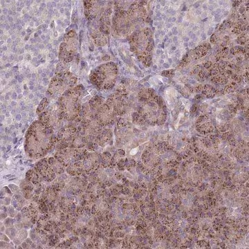 Anti-VRK2 antibody produced in rabbit, 1 X 100 µL (HPA047503-100UL)