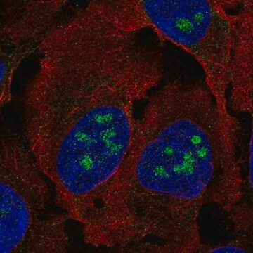 Anti-BLCAP antibody produced in rabbit, 100 µL (HPA047390-100UL)