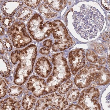 Anti-MRPL22 antibody produced in rabbit, 1 X 100 µL (HPA047063-100UL)