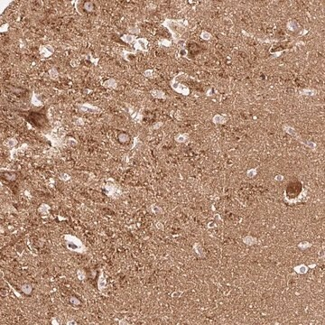Anti-NAPA antibody produced in rabbit, 1 X 100 µL (HPA046149-100UL)