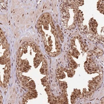 Anti-PEX14 antibody produced in rabbit, 1 X 100 µL (HPA046104-100UL)