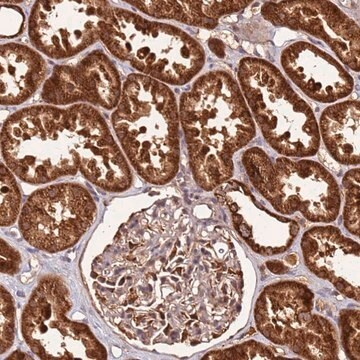 Anti-LYPLAL1 antibody produced in rabbit, 1 X 100 µL (HPA045806-100UL)
