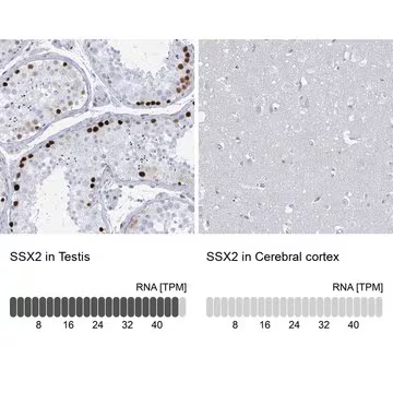 Anti-SSX2 antibody produced in rabbit, 100 µL (HPA045683-100UL)