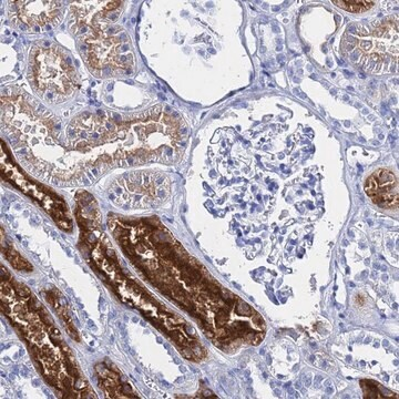 Anti-GGT2 antibody produced in rabbit, 100 µL (HPA045635-100UL)