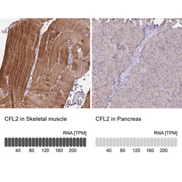 Anti-CFL2 antibody produced in rabbit, 100 µL (HPA045599-100UL)