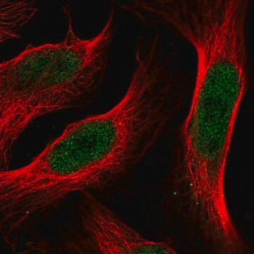 Anti-ANXA8 antibody produced in rabbit, 100 µL (HPA045246-100UL)