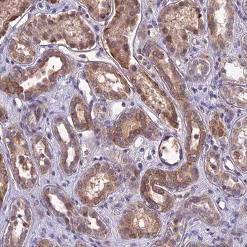 Anti-DMRTA1 antibody produced in rabbit, 1 X 100 µL (HPA044764-100UL)