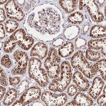 Anti-LACTB2 antibody produced in rabbit, 1 X 100 µL (HPA044391-100UL)