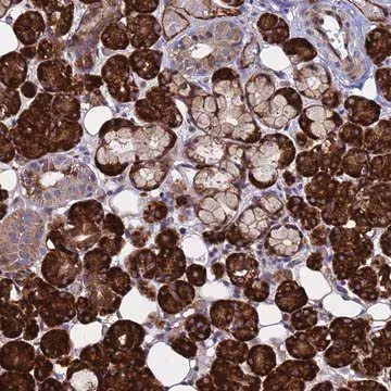 Anti-NOSTRIN antibody produced in rabbit, 1 X 100 µL (HPA044384-100UL)