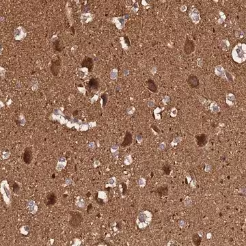 Anti-ADAMTS18 antibody produced in rabbit, 1 X 100 µL (HPA044326-100UL)