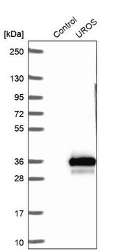 Anti-UROS antibody produced in rabbit, 1 X 100 µL (HPA044038-100UL)