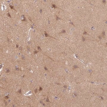 Anti-STAM antibody produced in rabbit, 100 µL (HPA043882-100UL)