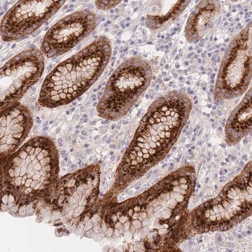 Anti-BORCS5 antibody produced in rabbit, 1 X 100 µL (HPA043627-100UL)