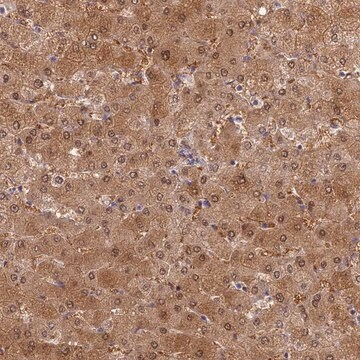 Anti-SLC25A41 antibody produced in rabbit, 1 X 100 µL (HPA043591-100UL)