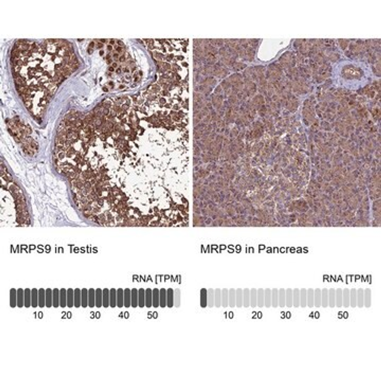 Anti-MRPS9 antibody produced in rabbit, 1 X 100 µL (HPA043476-100UL)